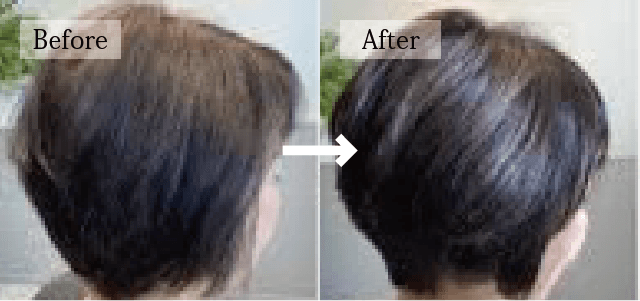 ビフォー アフター