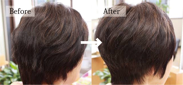ビフォー アフター